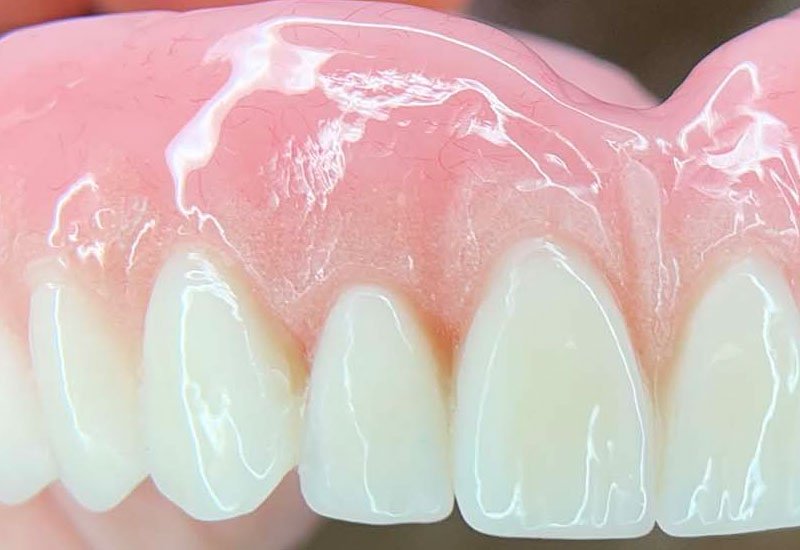 An image of a full upper denture showing gingivis staining to give the a more natural appearance