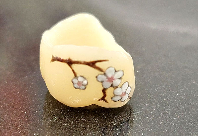 An image of an artificial tooth with a customized tattoo of a sprig of cherry blossoms