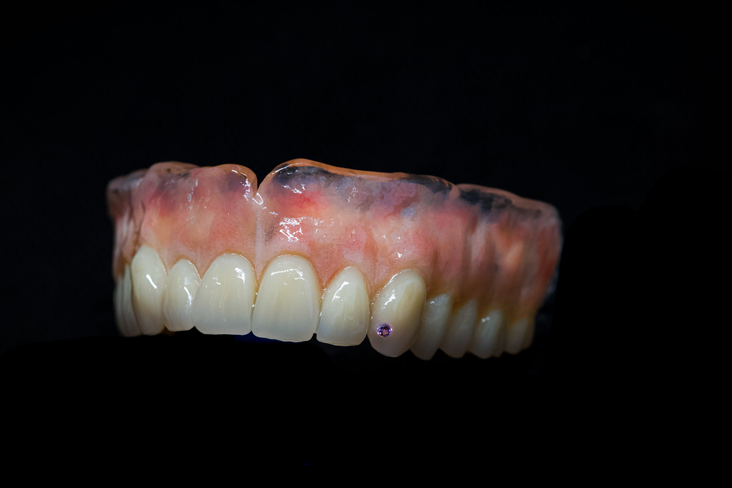 Jewel on a denture